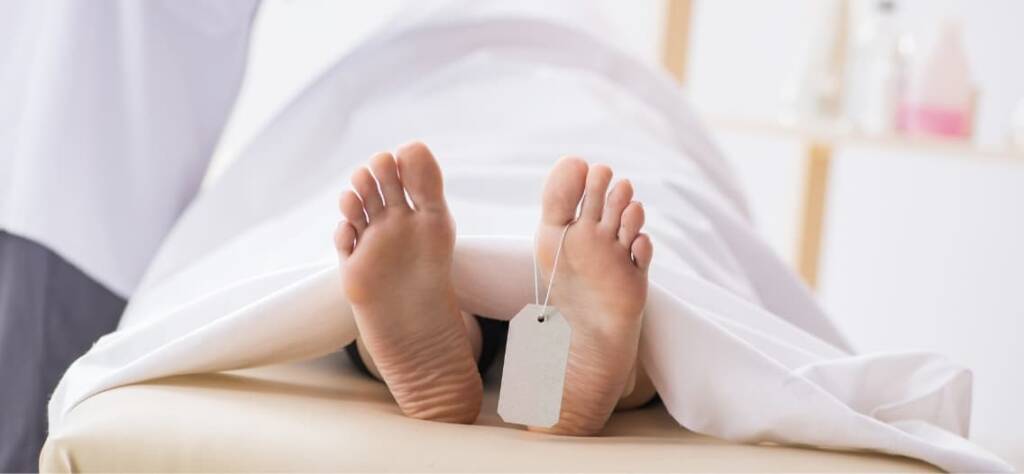 Fases del rigor mortis